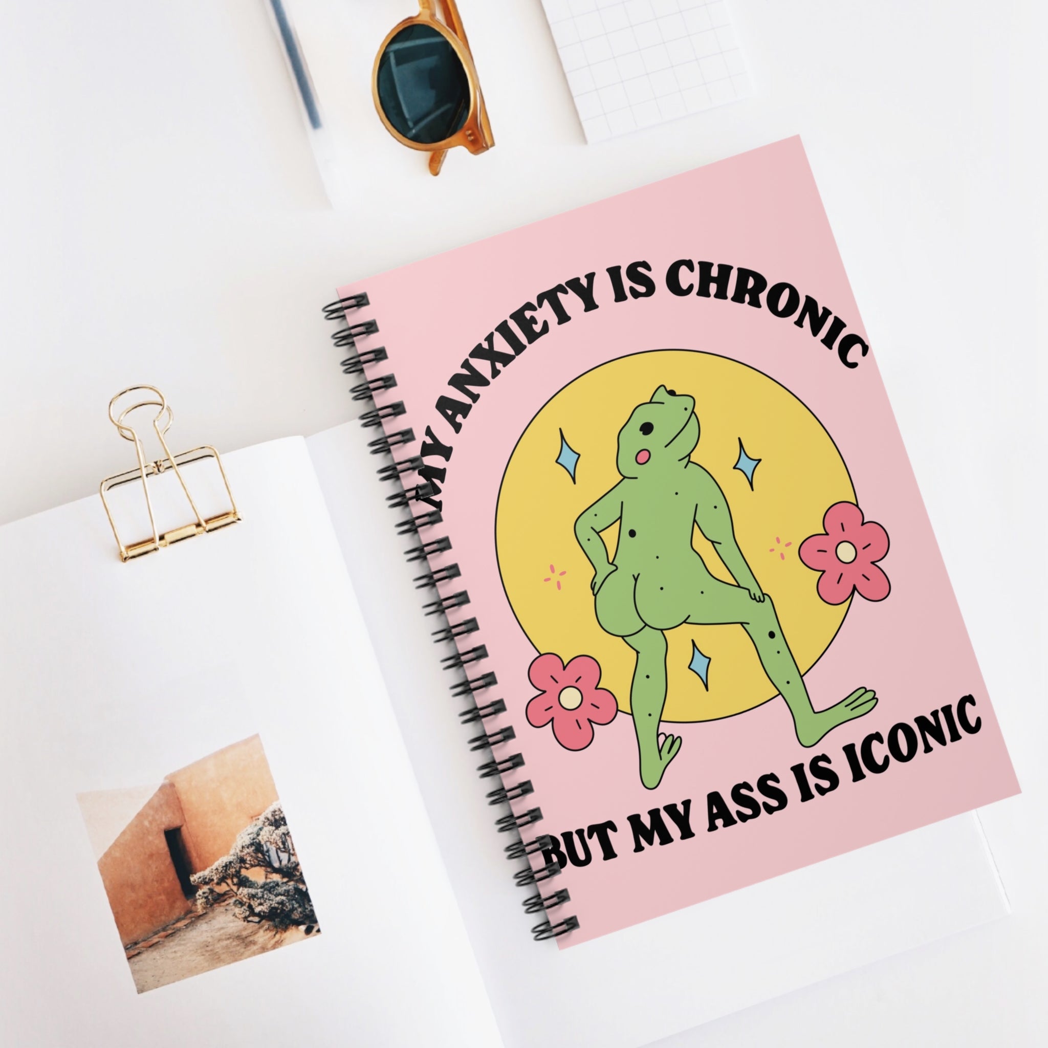 My Anxiety Is Chronic But My Ass Is Iconic A5 Lined Notebook